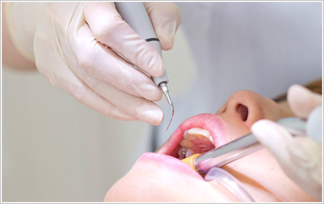  一般歯科（虫歯治療）